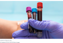 美国红十字会宣布血液严重短缺,呼吁美国民众献血