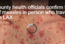 洛县卫生官员确认第4例麻疹病例,患者曾到访LAX及其他地点