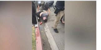 长滩市:ICE特工暴力逮捕男子致其手臂骨折